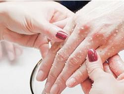 मैक्रेशन - हाथों और नाखूनों की त्वचा पर सावधानीपूर्वक ध्यान त्वचा का मैक्रेशन क्या है