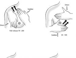 Kaip padidinti krūtis papildomu masažu: technika ir procedūros efektyvumas
